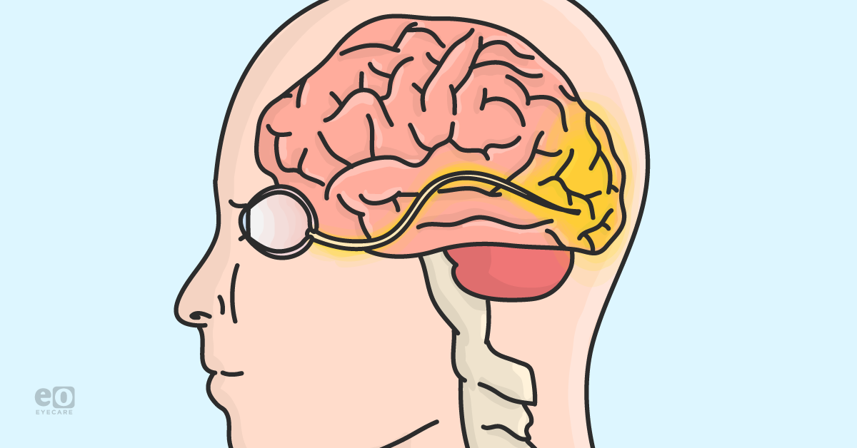 Screening for Vertical Heterophoria: A Guide for Optometrists