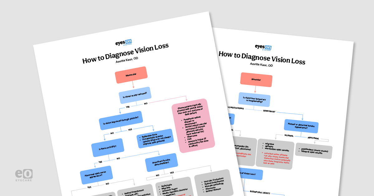 How to Diagnose Vision Loss—with Downloadable Flowchart