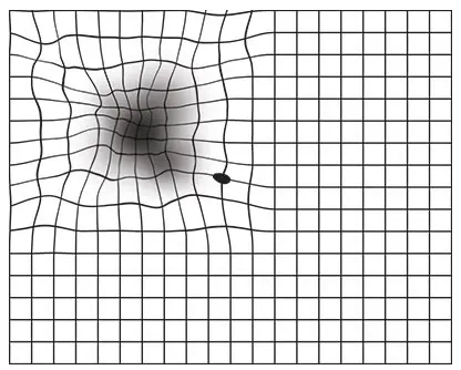 Amsler Grid Distorted