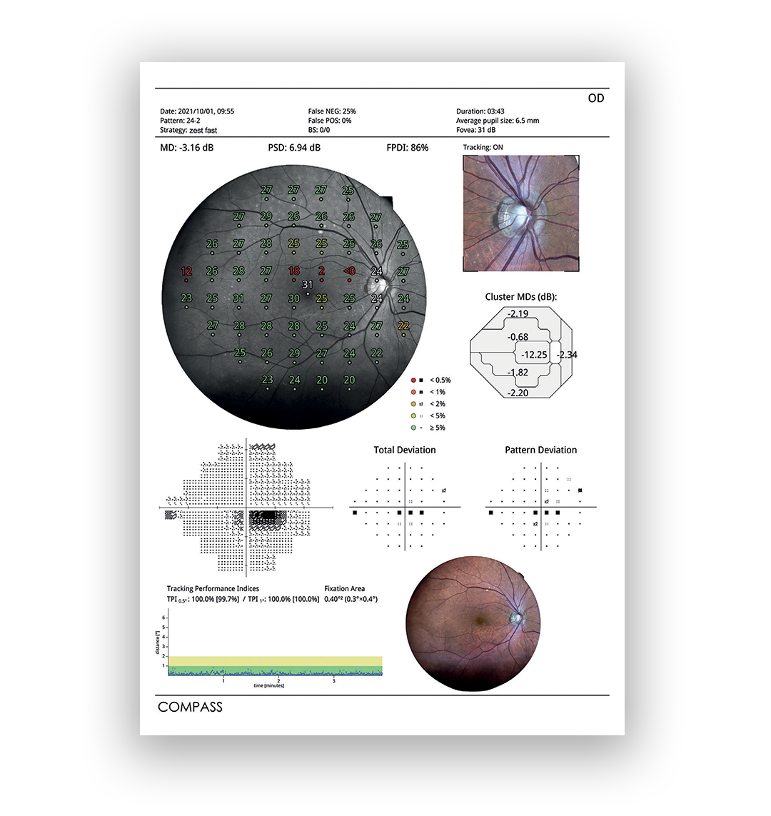 ZestFast_iCare_COMPASS