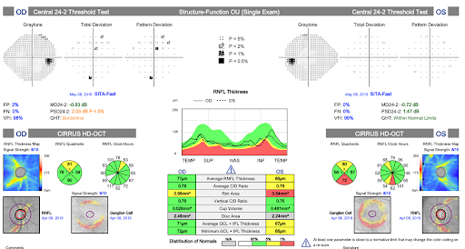 Structure-Function Report POAG