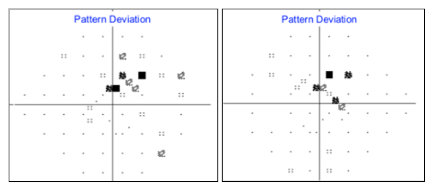 Pattern Deviation SITA Faster