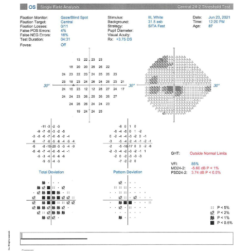 Visual Fields Patient Case 1