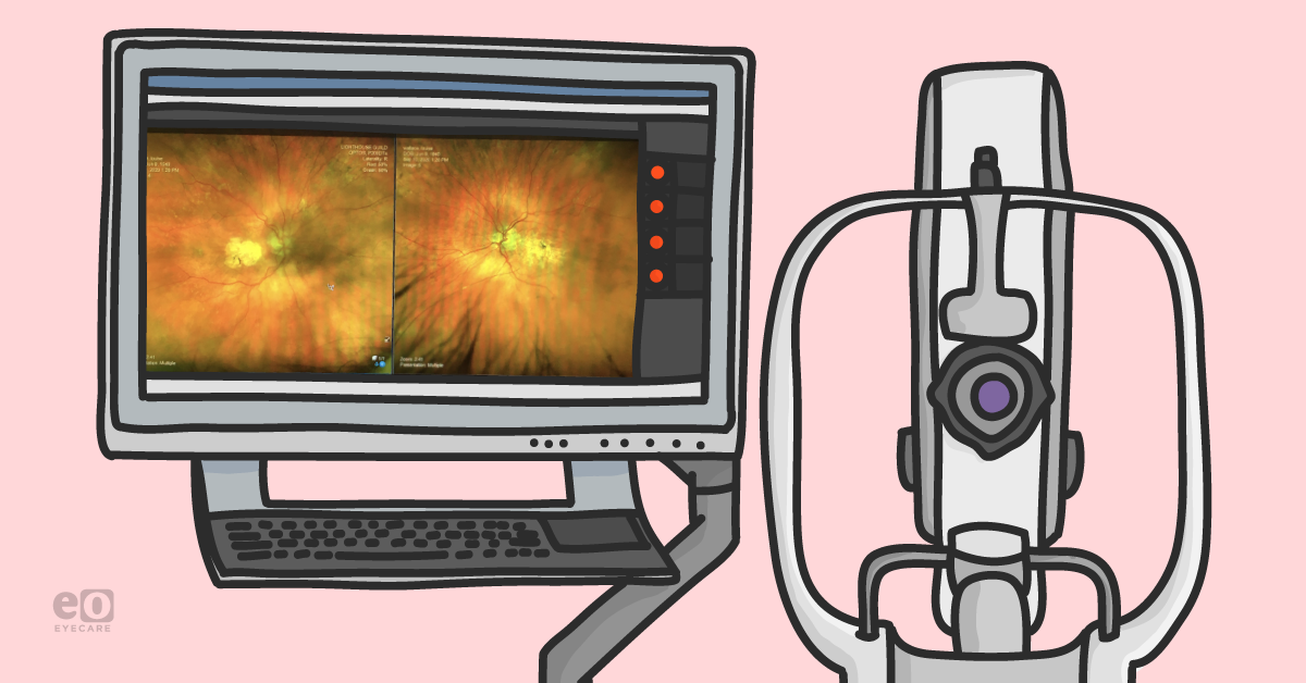 How Ultra-Widefield Imaging Can Boost Your Practice and Benefit Your Patients