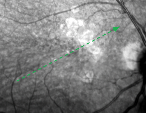 NIR Baseline OD