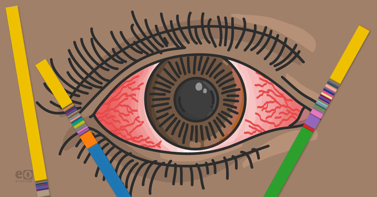 The Potential for Genetic Sequencing for Targeting Infectious Keratitis 