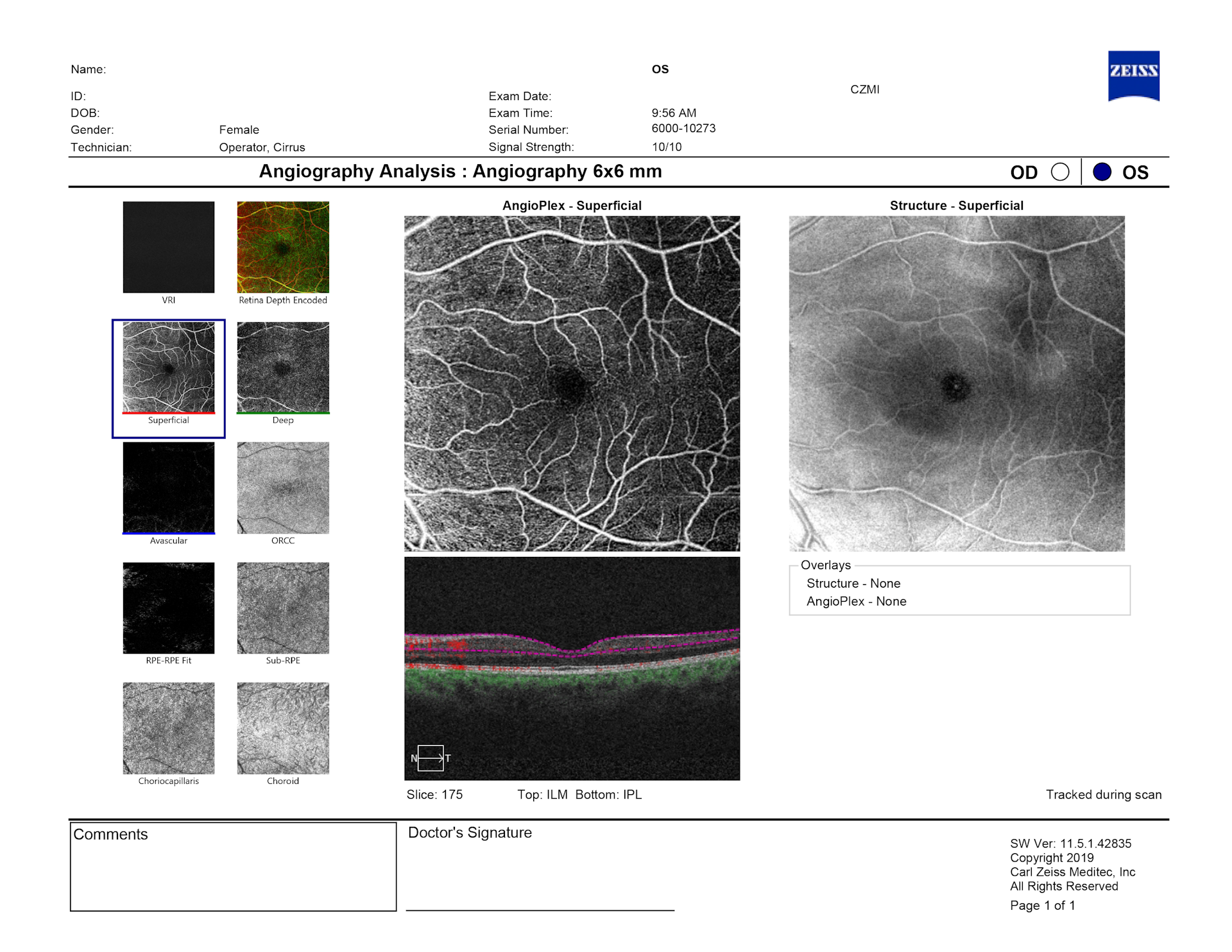 Angiography analysis