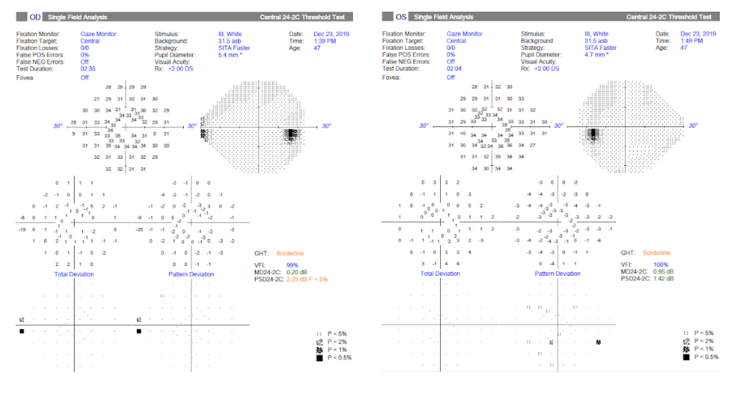 10-point visual field.png