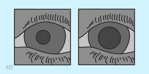 Dark Adaptation and Other New Breakthroughs in AMD Diagnosis