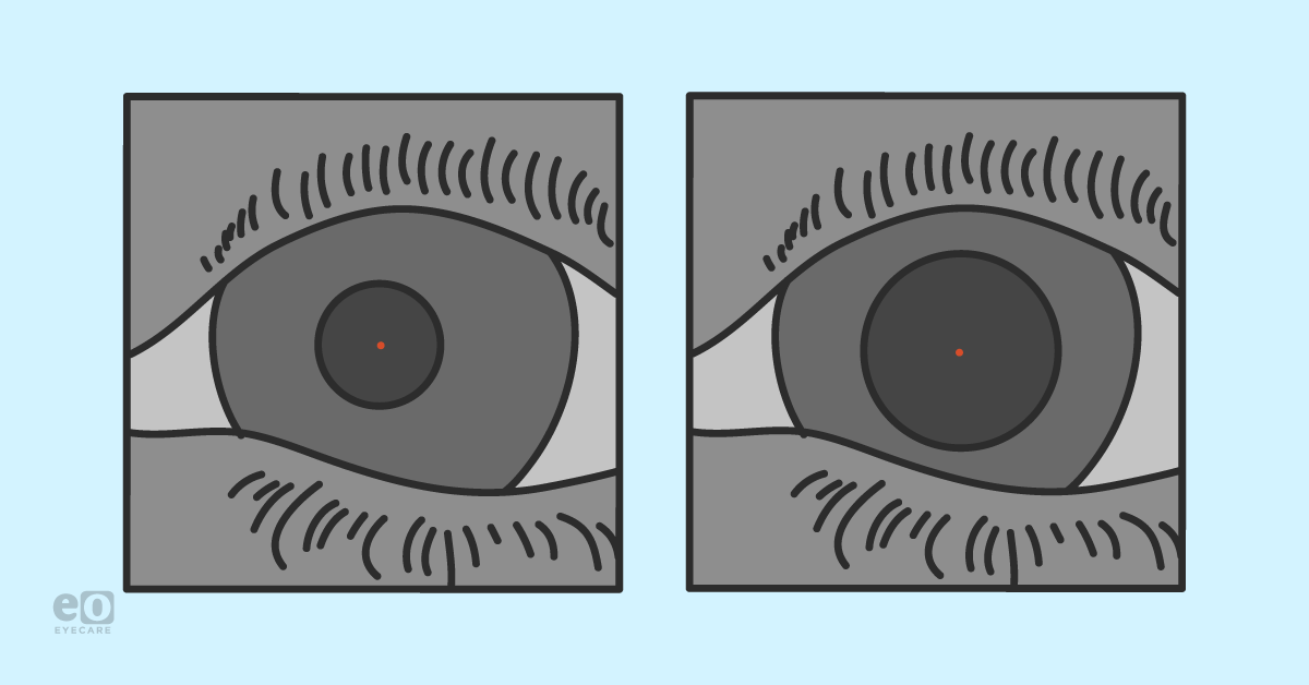 Dark Adaptation and Other New Breakthroughs in AMD Diagnosis