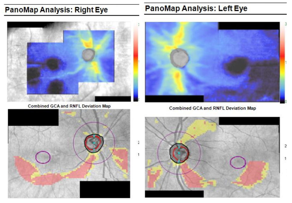 Panomap Analysis