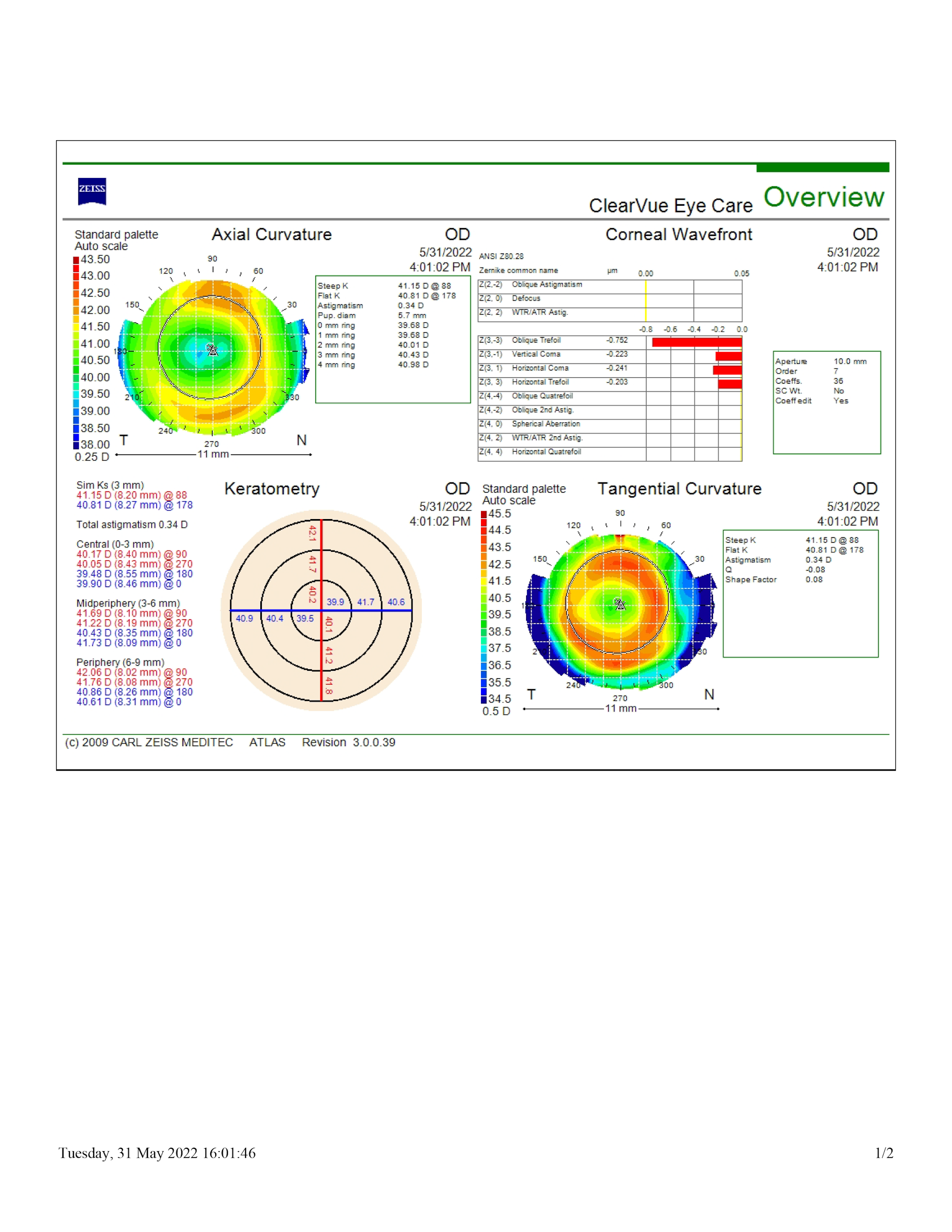 Corneal topography