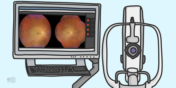 Diabetic Retinopathy—Imaging and Future Telemedicine