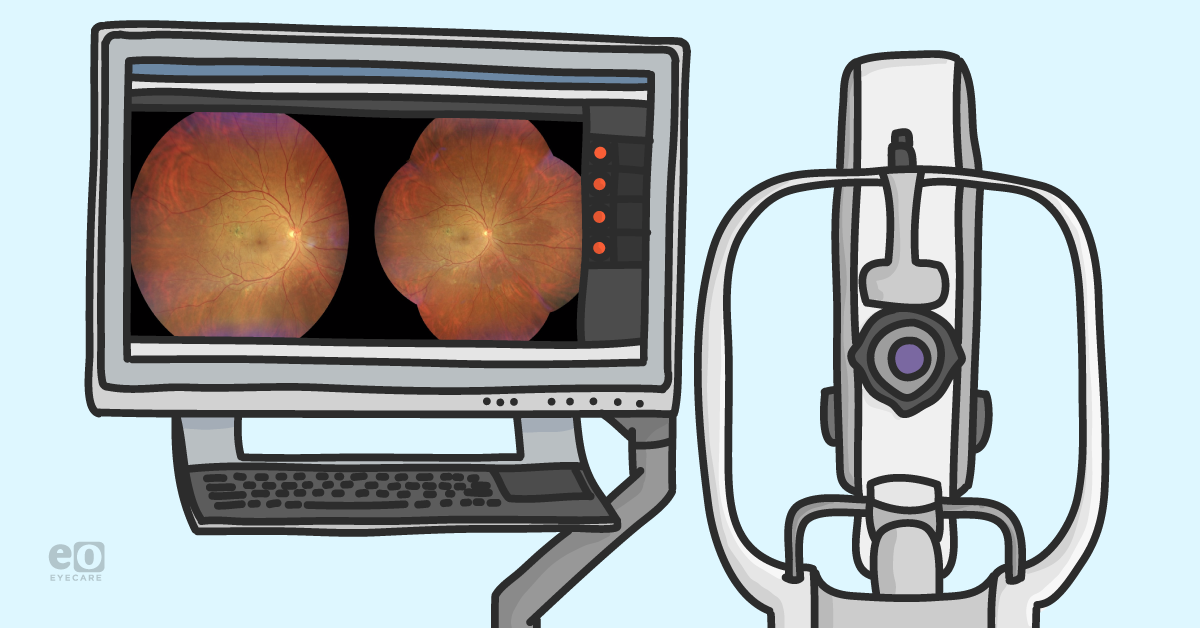 Diabetic Retinopathy—Imaging and Future Telemedicine