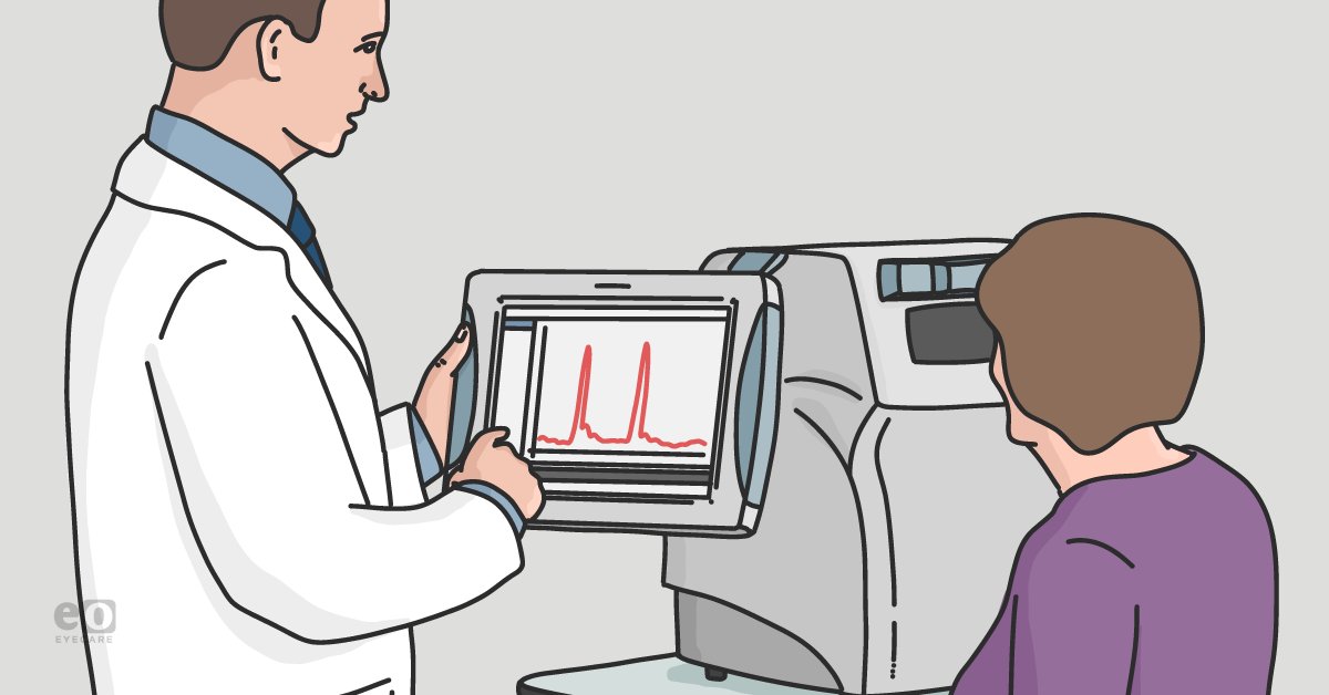 Glaucoma & Corneal Hysteresis: Going Beyond Central Corneal Thickness