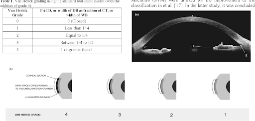 von-hericks-angle-slit-beam.png