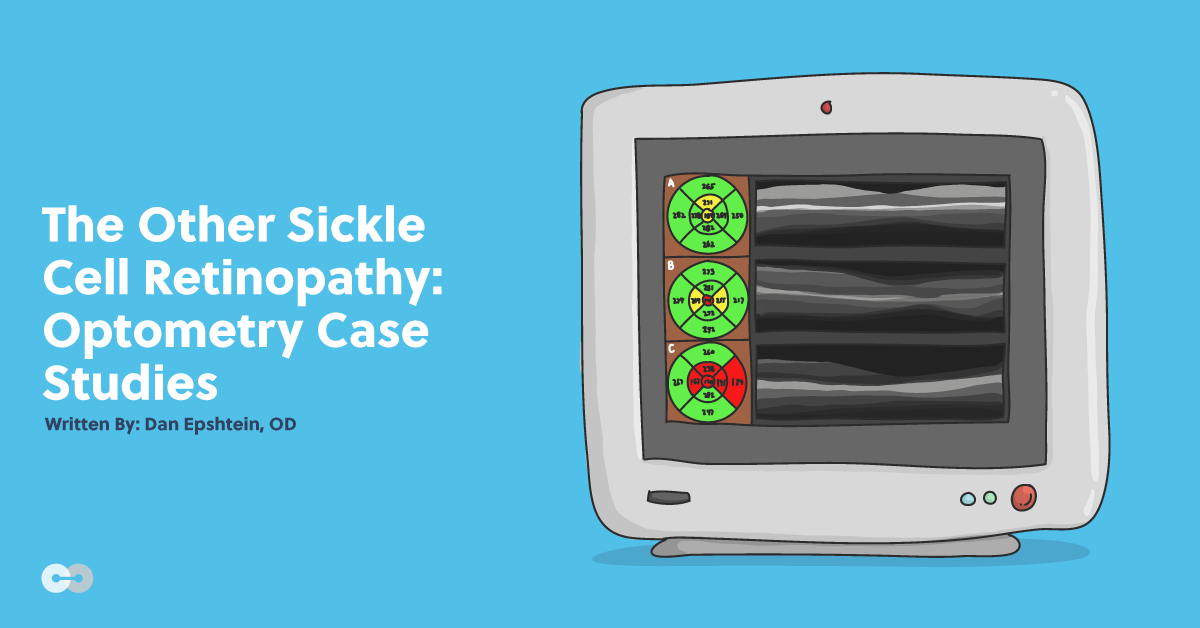 The Other Sickle Cell Retinopathy: Optometry Case Studies