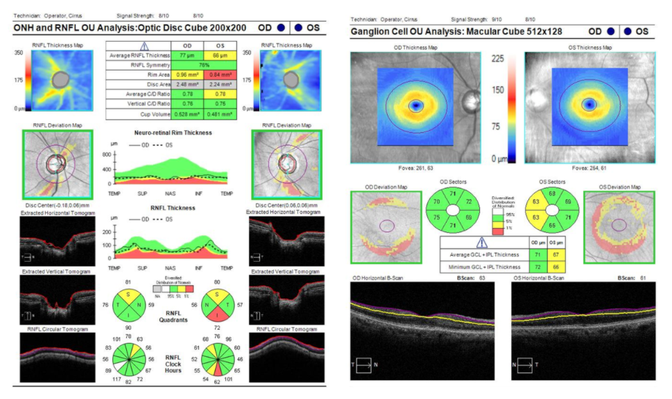 Panomap Analysis