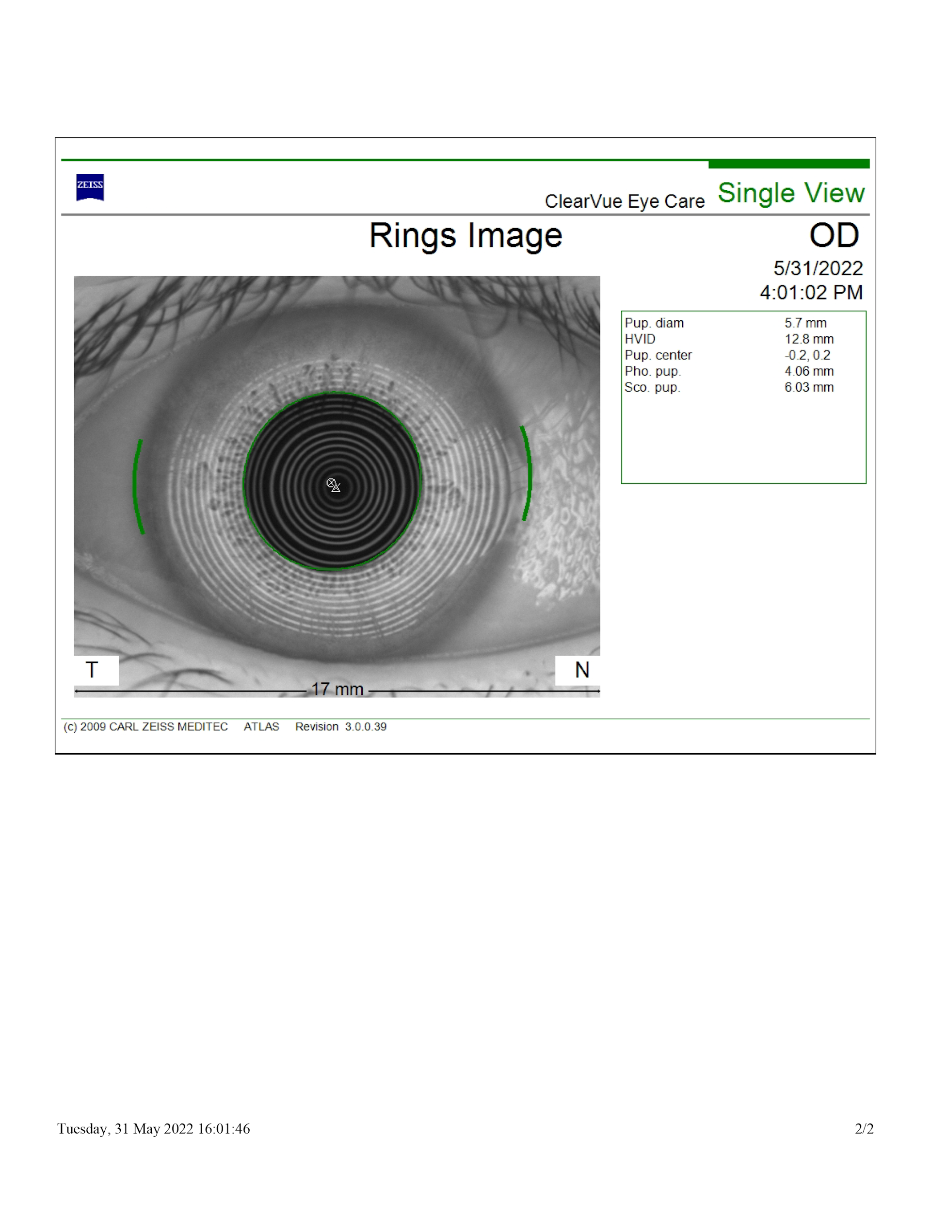 Corneal topography