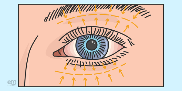 An OD’s Guide to Oculoplastics Referrals