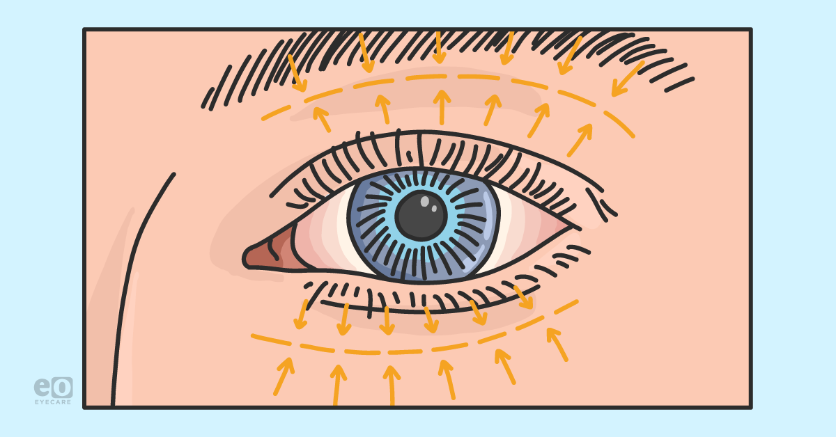 An OD’s Guide to Oculoplastics Referrals