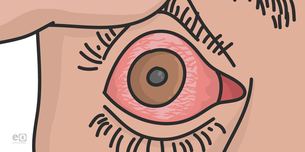 A Modern Framework for Uveitis Diagnosis and Treatment