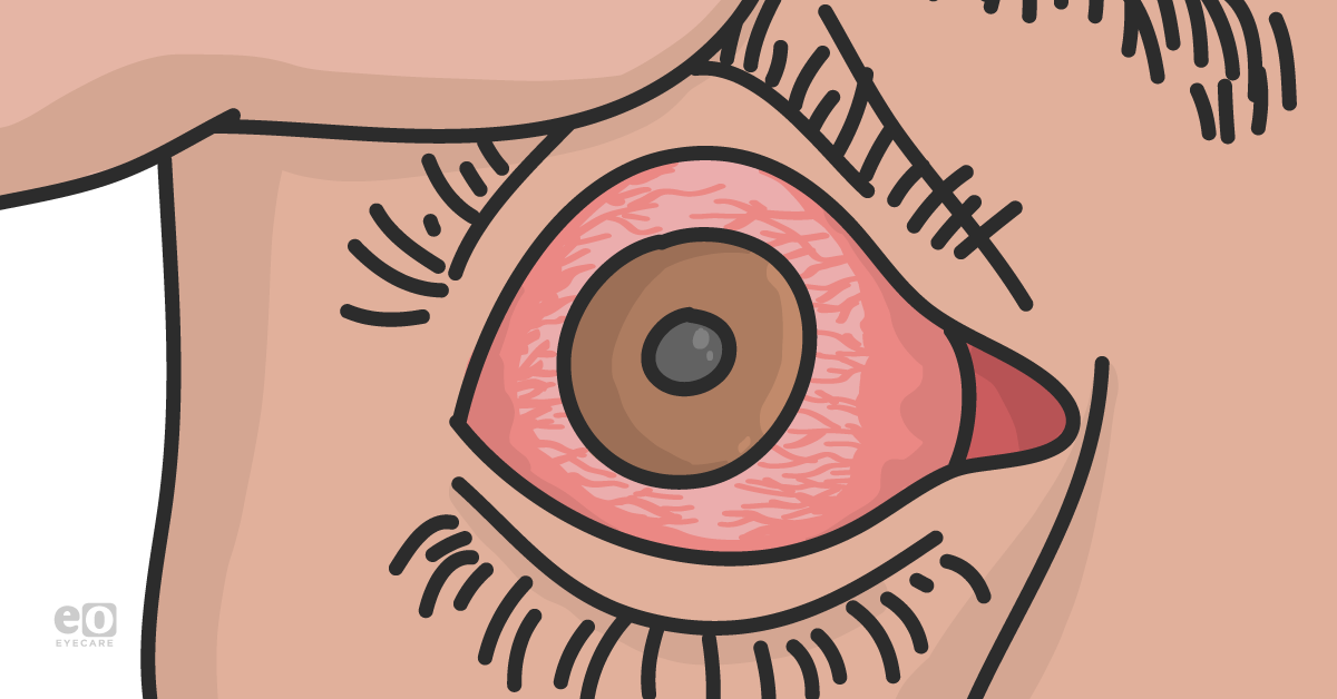 A Modern Framework for Uveitis Diagnosis and Treatment