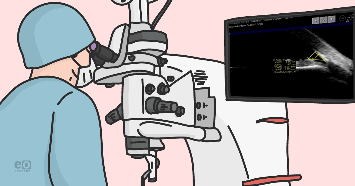 Anterior Segment OCT for Anterior Segment Surgery