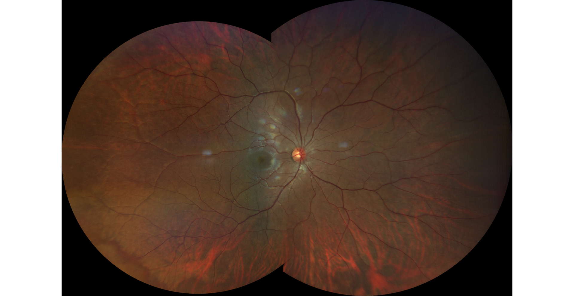 Fundus photo 1