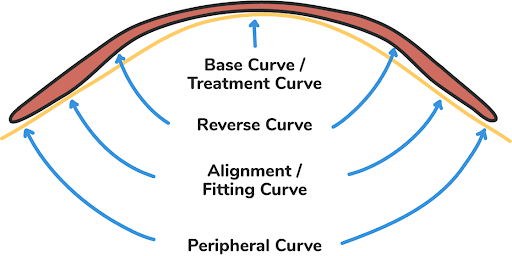 https://covalentcareers3.s3.amazonaws.com/media/original_images/Anatomy_of_an_Orthokeratology_Lens.png