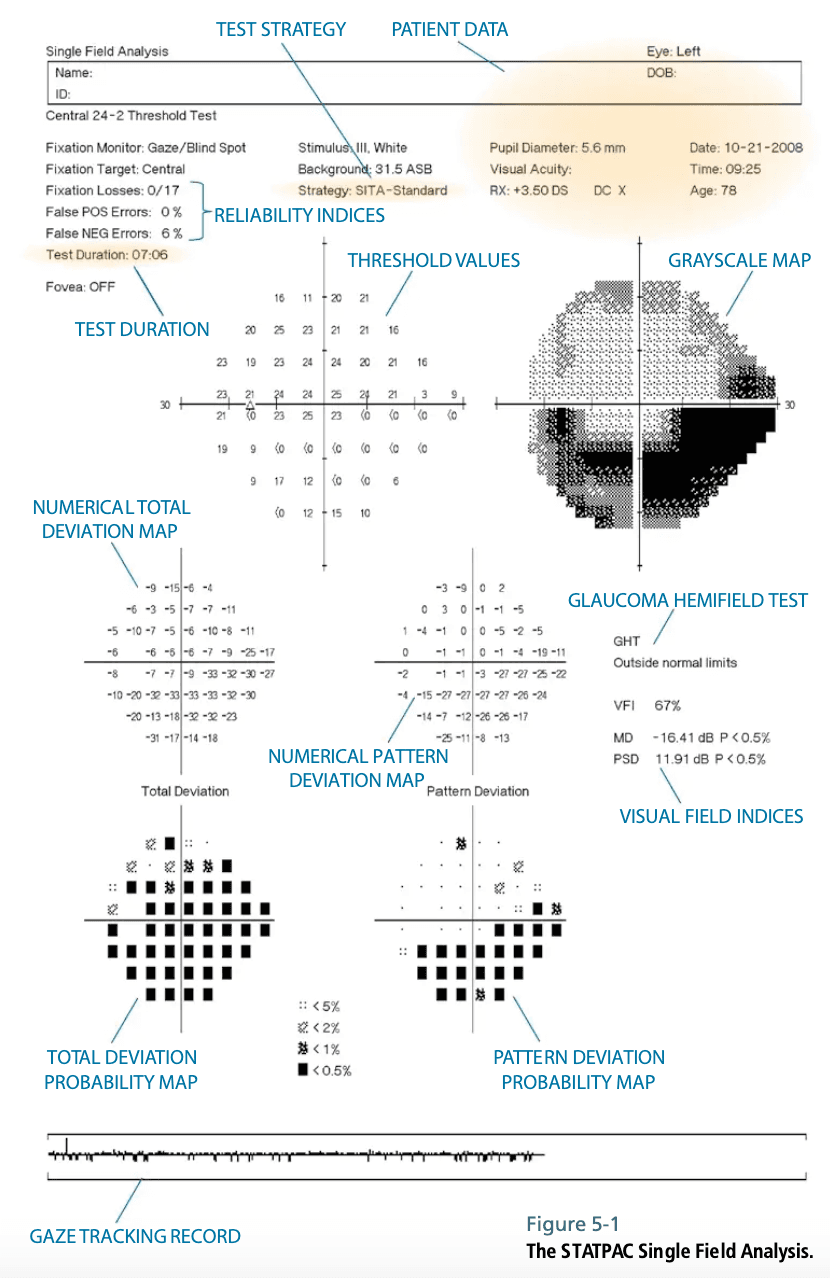 https://covalentcareers3.s3.amazonaws.com/media/original_images/Humphrey_Visual_Field_Full.png