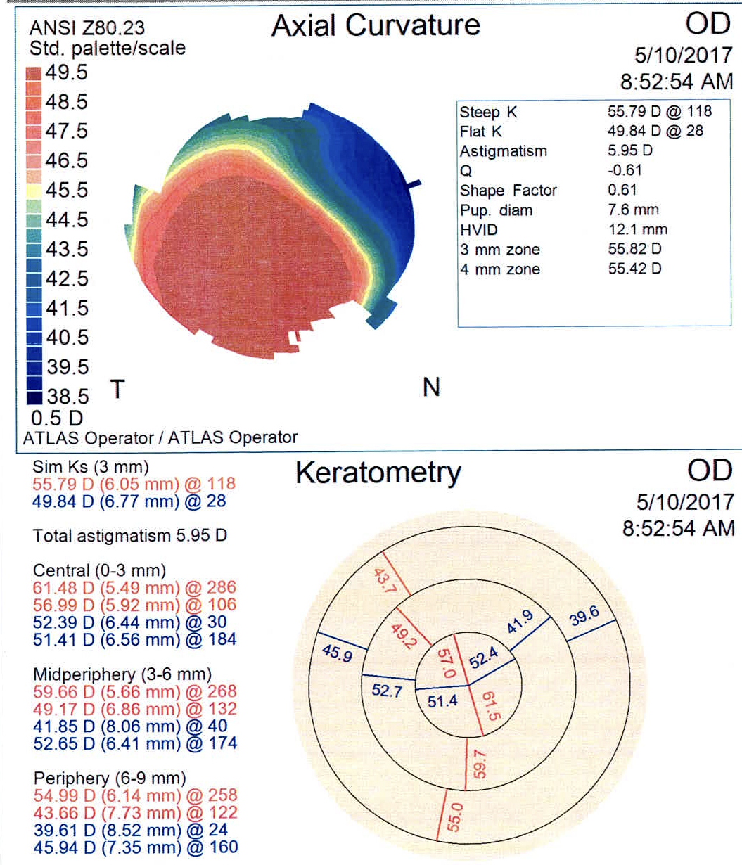 https://covalentcareers3.s3.amazonaws.com/media/original_images/therapeutic-refractive-surgery-inread-image1.png