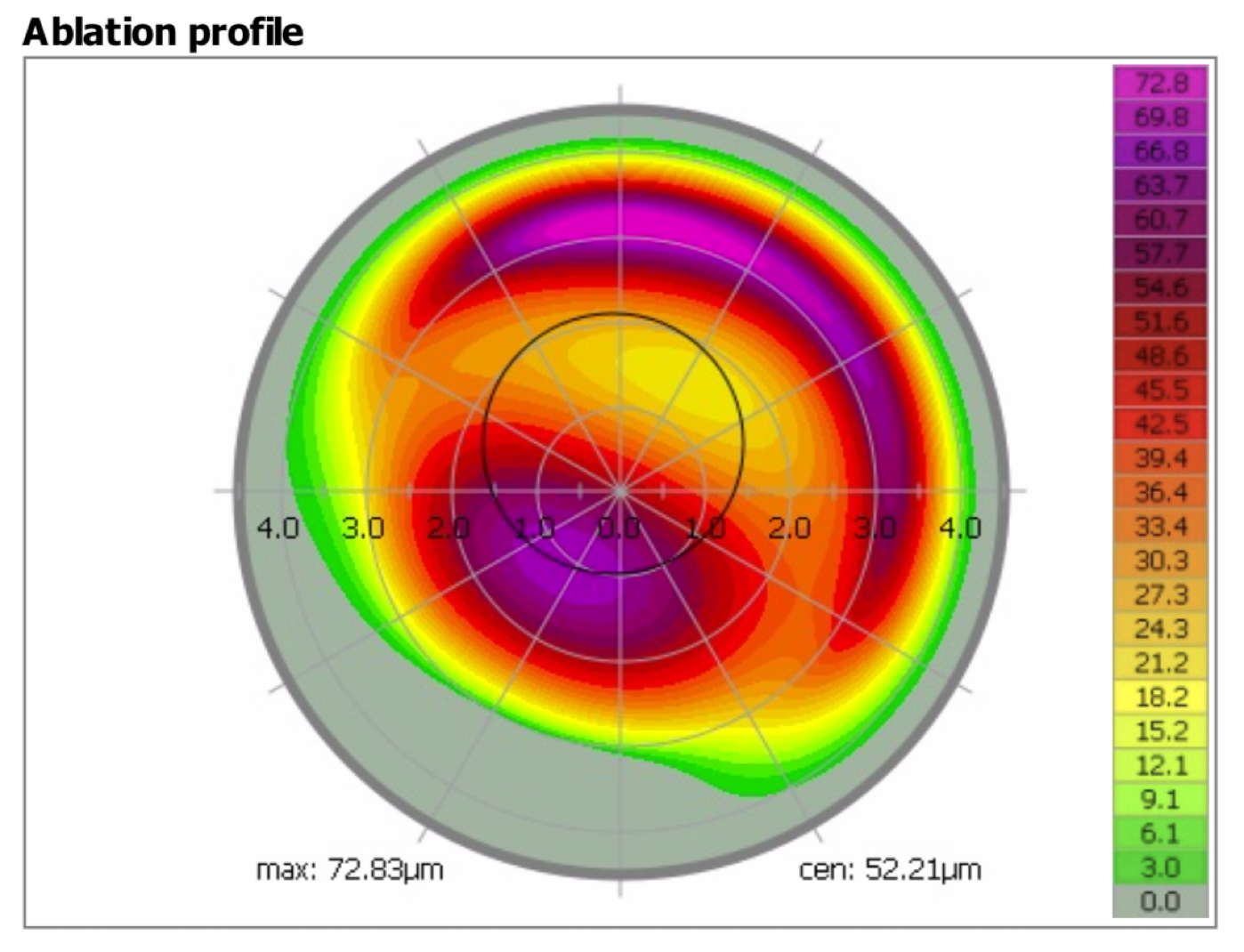 https://covalentcareers3.s3.amazonaws.com/media/original_images/therapeutic-refractive-surgery-inread-image2.png