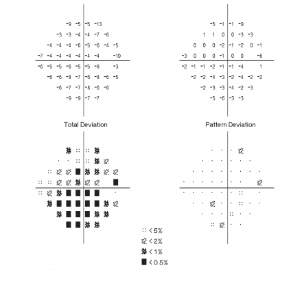 https://covalentcareers3.s3.amazonaws.com/media/original_images/total_vs_pattern_deviation.png