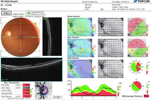 https://covalentcareers3.s3.amazonaws.com/media/original_images/traumatic_optic_neuropathy_OS_cQPBoFh.jpg